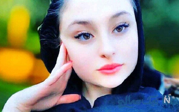 لایو نیکای پایتخت درباره جراحی زیبایی صورتش جنجالی شد + فیلم دیده نشده