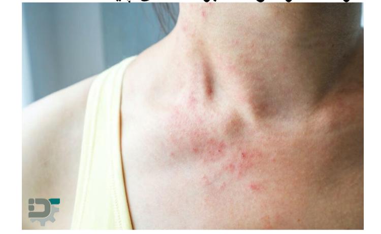 مضرات سولفات برای سلامتی
