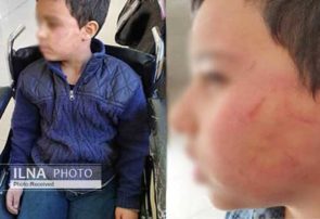 تنبیه بدنی دانش‌آموز ۱۰ ساله توسط معلم ورزش