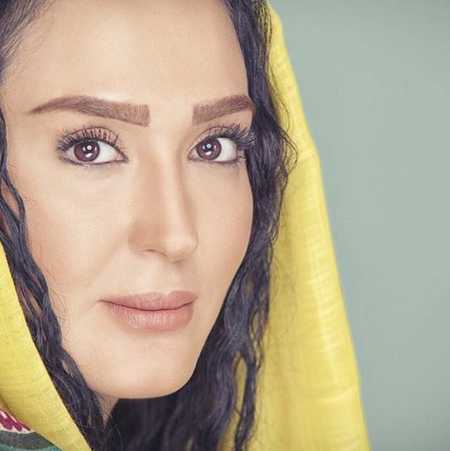 عکس قبل و بعد از عمل زهره فکور صبور | چهره پژمرده زهره فکور صبور یک روز قبل از مرگ