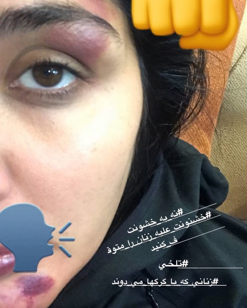 فیلم لورفته از خفت گیری وحشتناک از مریم معصومی در صحنه فیلم برداری + فیلم و عکس