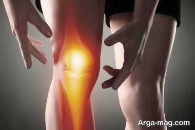 آرتروز چیست؟ + توصیه های پزشکی و خانگی