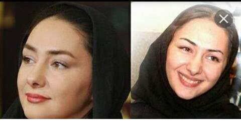 عکس لورفته از قبل عمل زیبایی هانیه توسلی + عکس