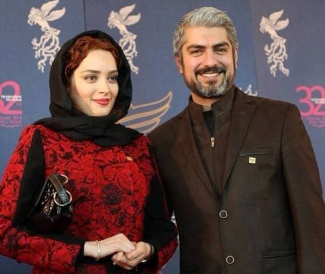 عکس قبل عمل زیبایی همسر مهدی پاکدل مردم را شوکه کرد | بهنوش طباطبایی چقدر تغییر کرده