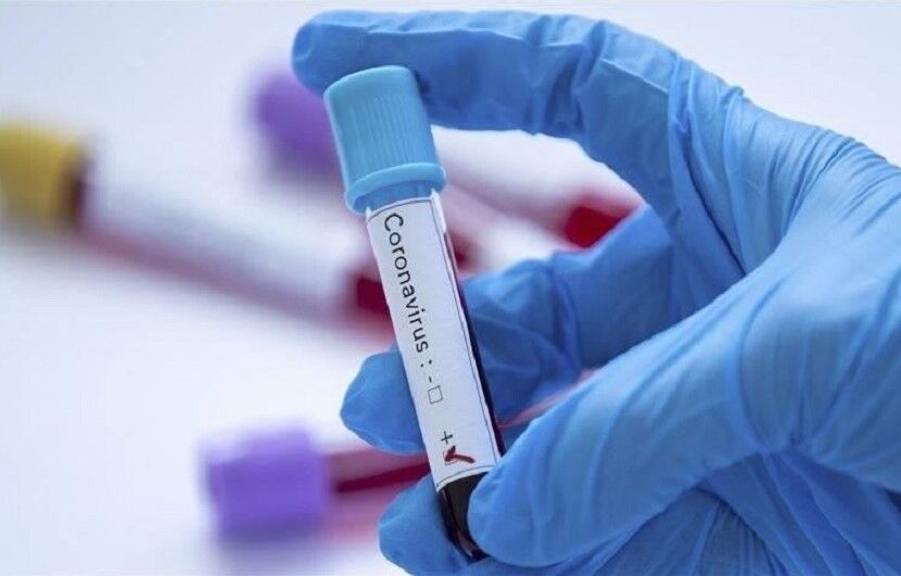 احتمال ابتلای اطرافیان ۲ بیمار فوت شده به کرونا زیاد است
