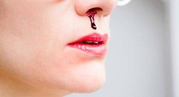 دلیل خونریزی مکرر بینی چیست؟