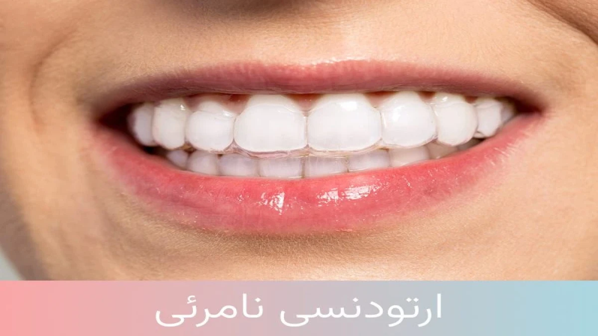 قبل از ارتودنسی نامرئی، حتماً این نکات مهم را بخوانید