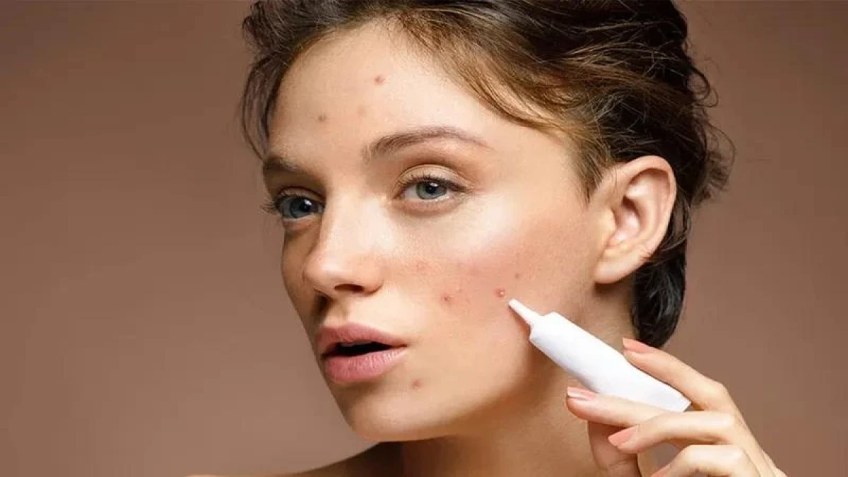 چرا جای جوش ماه‌ها روی پوست باقی می‌ماند؟ راهکارهای مؤثر چیست؟