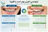 ارتودنسی نامرئی بهتر است یا فلزی؟ + مقایسه کامل مزایا، معایب و هزینه