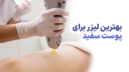 آیا لیزر موهای زائد باعث تیرگی یا روشن شدن پوست می‌شود؟ حقیقتی که باید بدانید