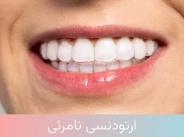 قبل از ارتودنسی نامرئی، حتماً این نکات مهم را بخوانید
