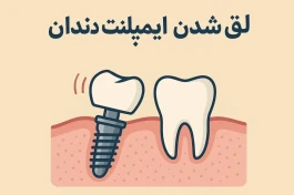 ایمپلنت دندان چرا لق می‌شود؟ ۷ اشتباهی که نتیجه درمان را خراب می‌کند