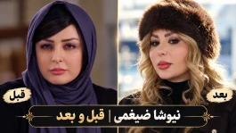 تغییر چهره نیوشا ضیغمی | تلخ ترین بلای زیبایی + عکس